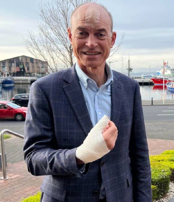 Mr Barnett pictured in a Facebook post about his weekend sporting injury.